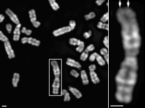 ヒト細胞の分裂期染色体（左）とその拡大図（右）。