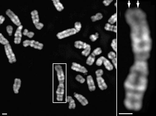 ヒト細胞の分裂期染色体（左）とその拡大図（右）。